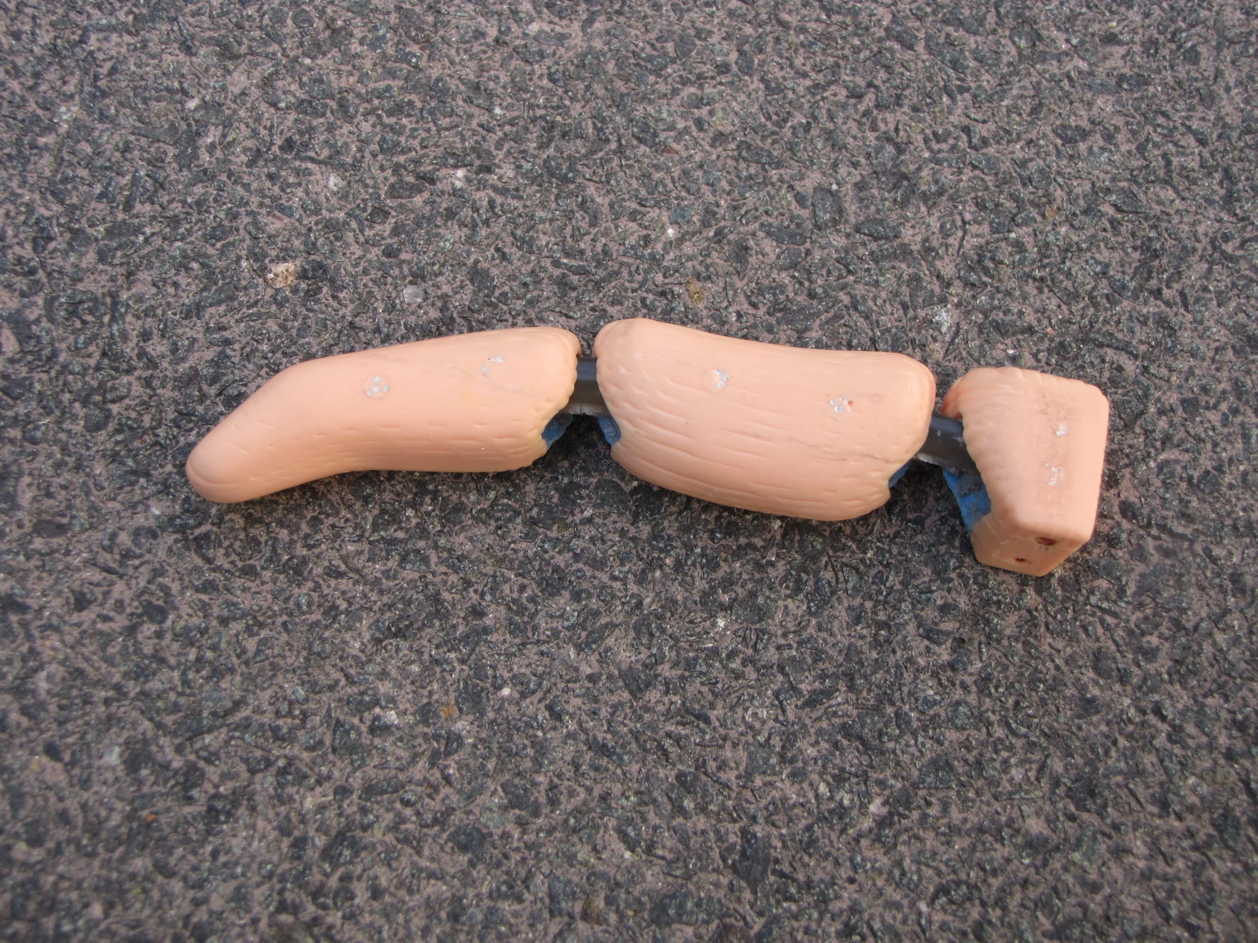 Prosthetic Hand — Kayla Matheus