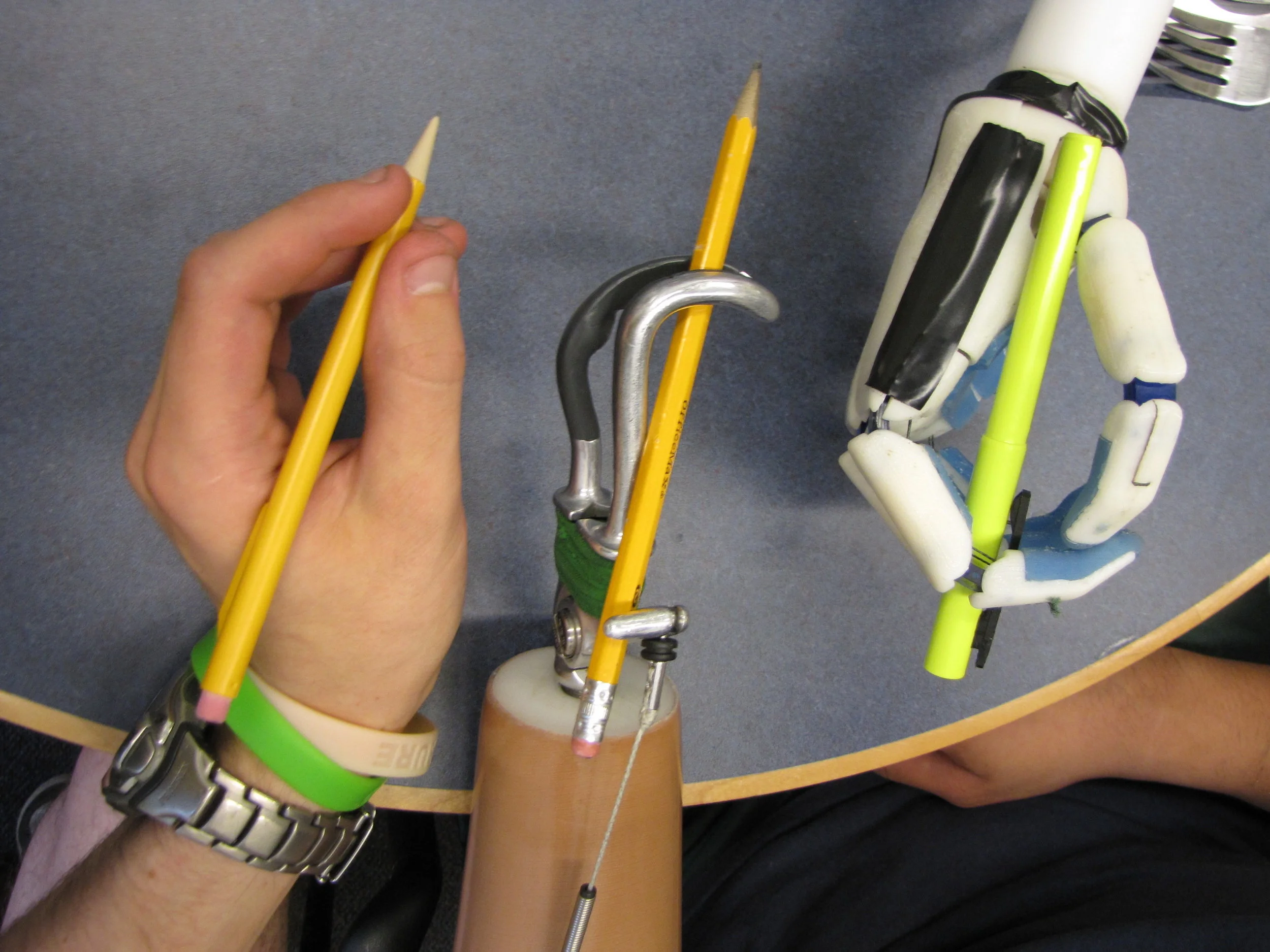 Prosthetic Hand — Kayla Matheus