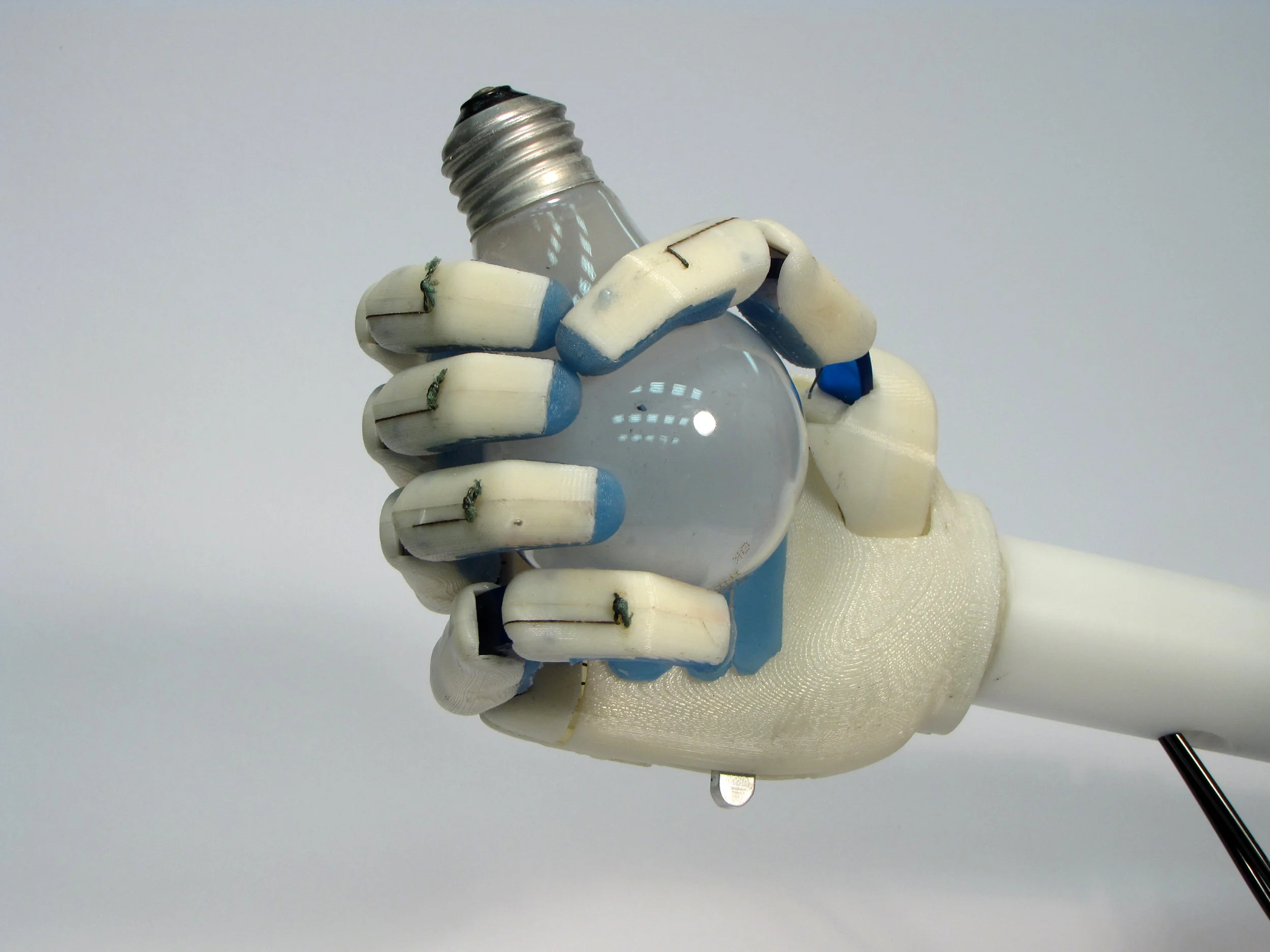 Prosthetic Hand — Kayla Matheus