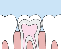 Sealants.gif