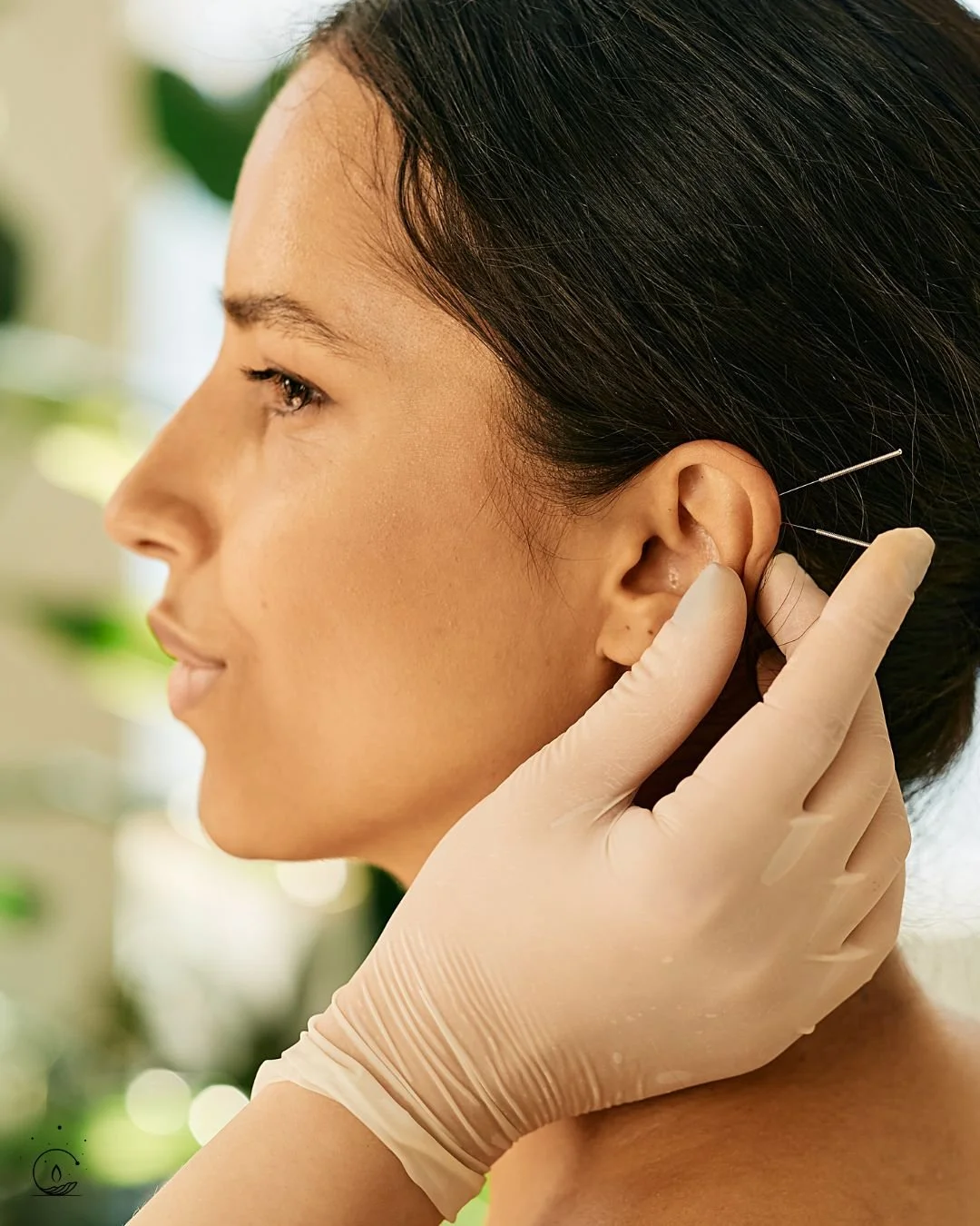 Ear acupuncture and auriculotherapy treatment using points on the external ear