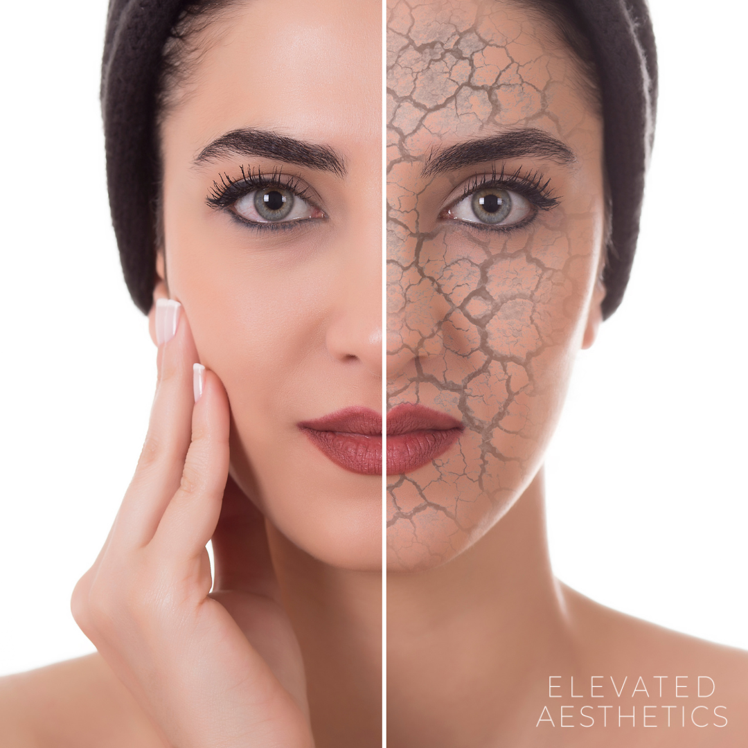 5 Skincare Tips to Consider this Winter 
