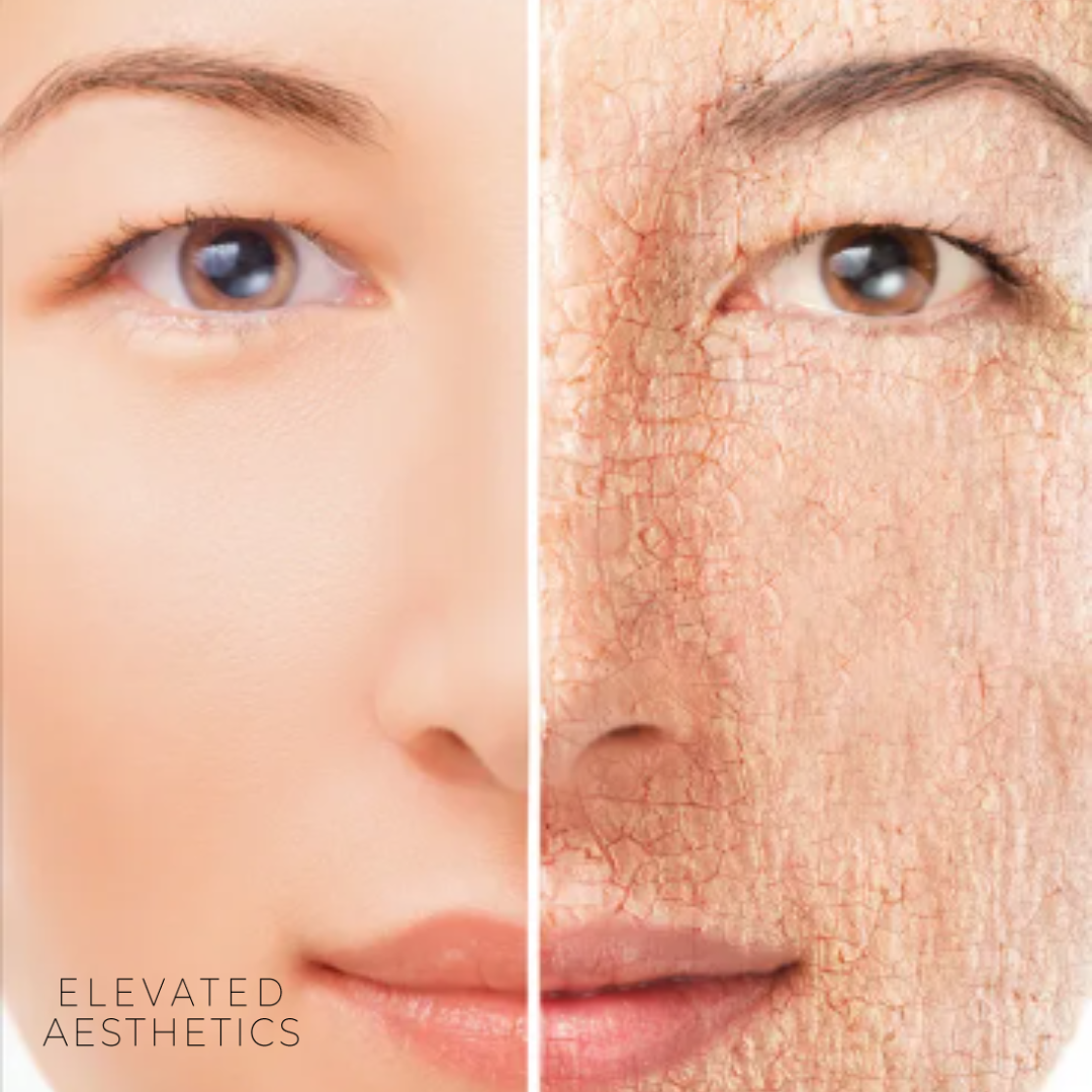 Is my skin dry or dehydrated? Or maybe both?
