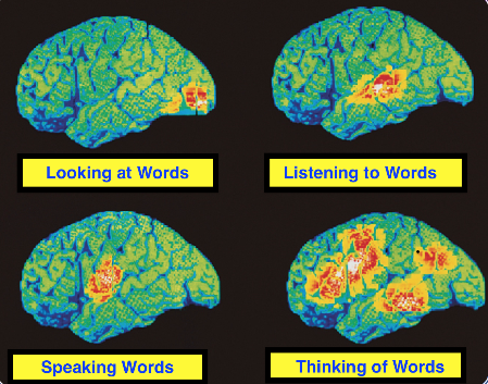 Brains and Beauty: Adaire Byerly's Neural Observations On Human ...