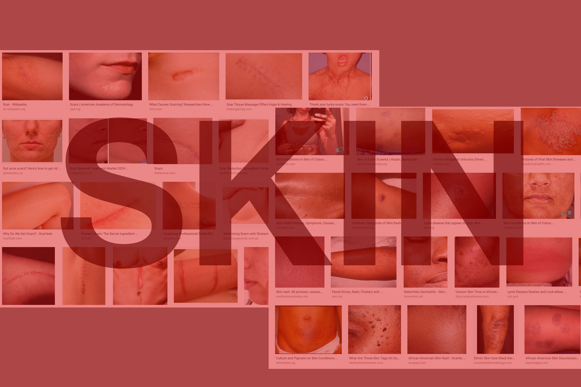SKIN-2000.jpg
