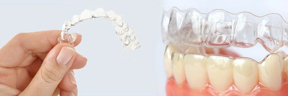 Alternative+to+Braces_Header.jpg