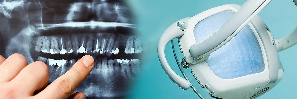 Teeth Cleaning in Encinitas