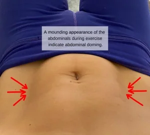 How to avoid abdominal doming and bulging|Exercise — Empowered Fit ...