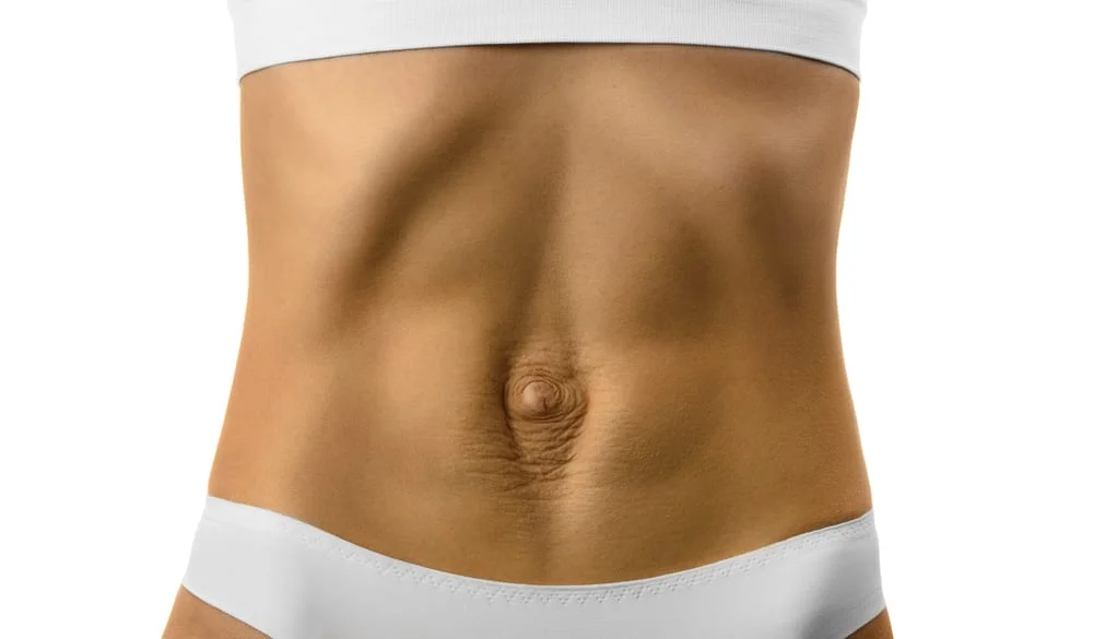 3 things you can do NOW to heal your Diastasis Recti 