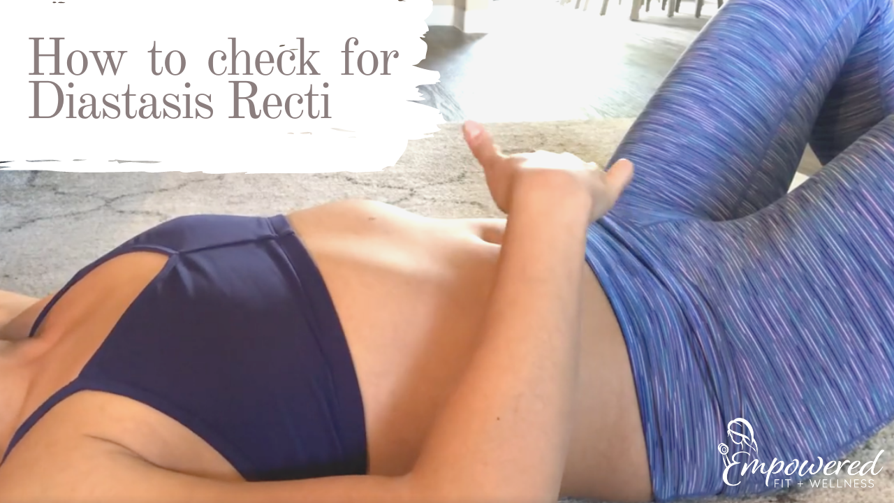 How to check for diastasis recti 