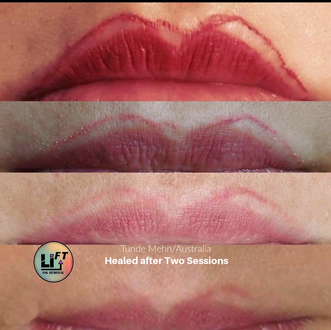 Lips-2-sessions.png