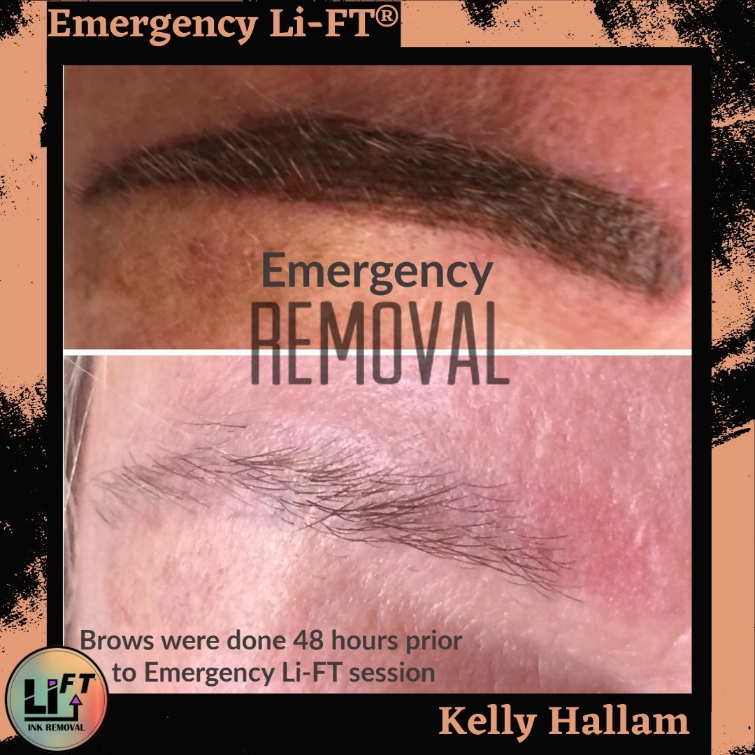 Kelly-Hallam-emergency-lift-with-border.jpg