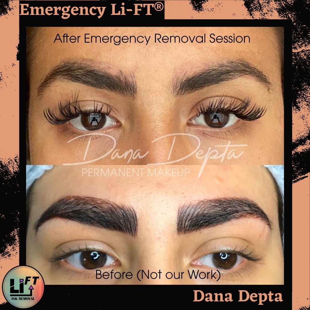 Dana-Depta-Emergency-lift-with-border.jpg