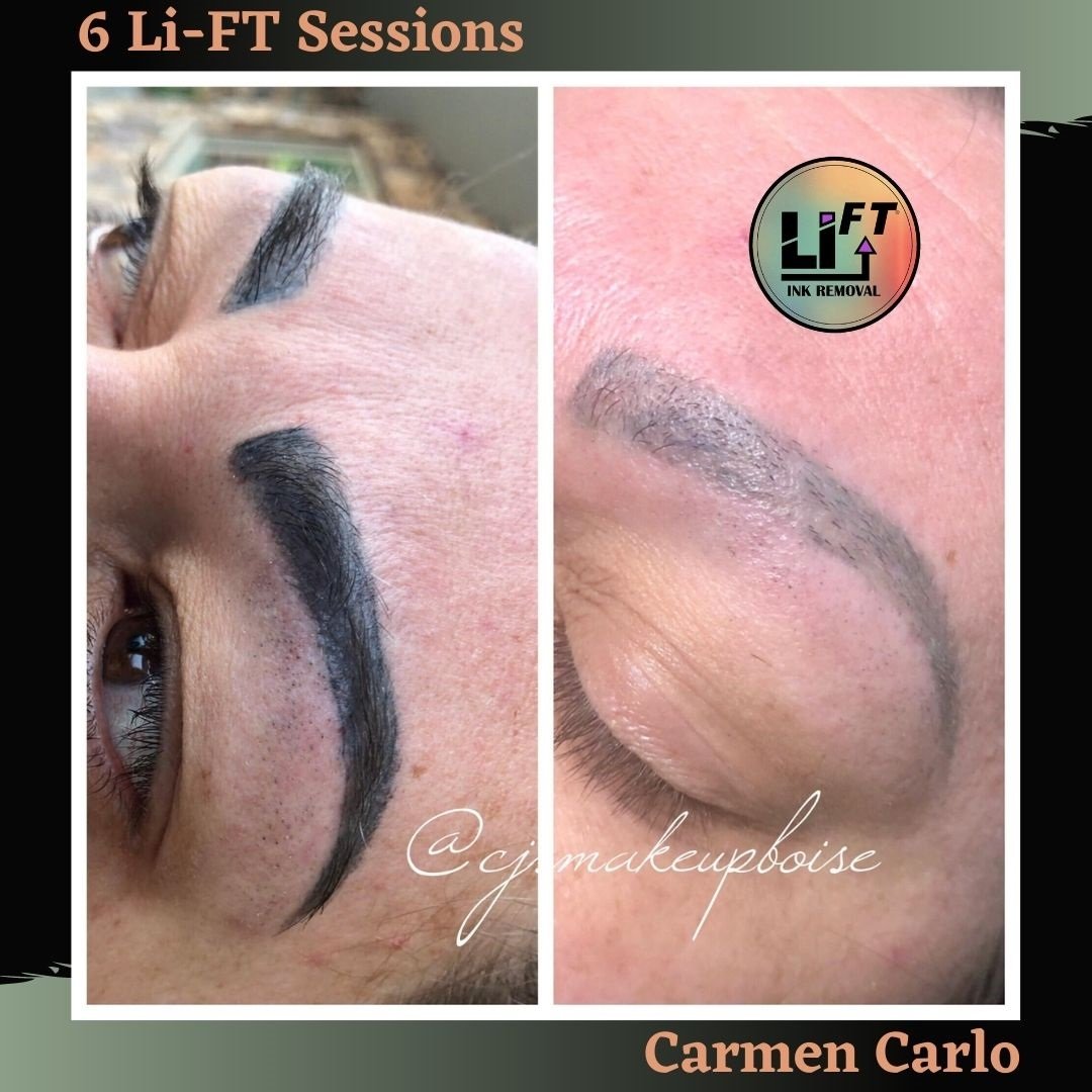 6-sessions-healed-Carmen-Carlo.jpg