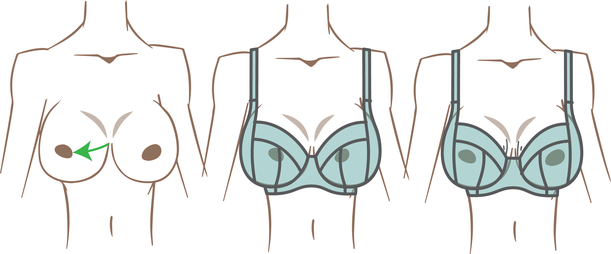 Inner Fullness Alteration for Large Breasts — LilypaDesigns