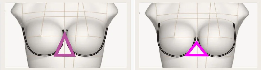 Center Gore Bridge Shape and Breast Anatomy