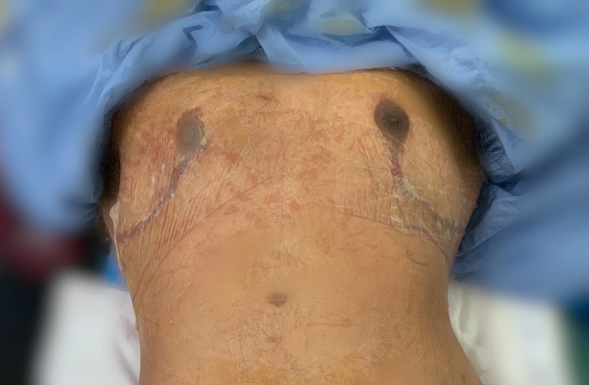 Breast redo.jpg