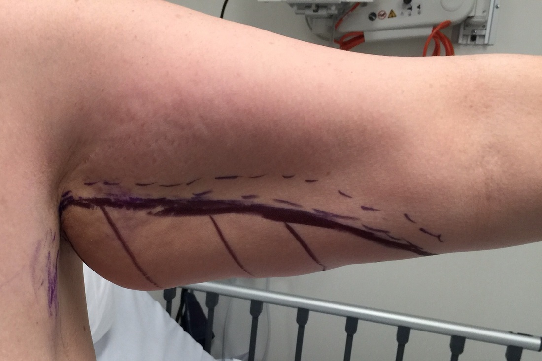 arm1.jpg