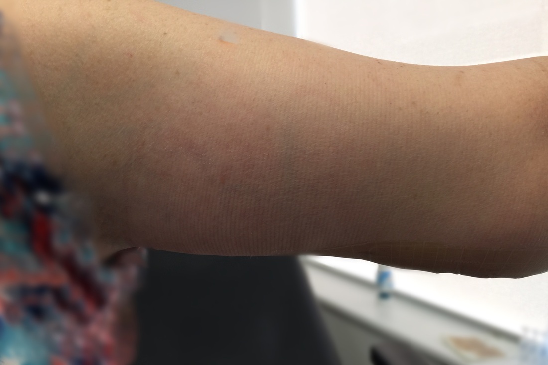 arm3.jpg