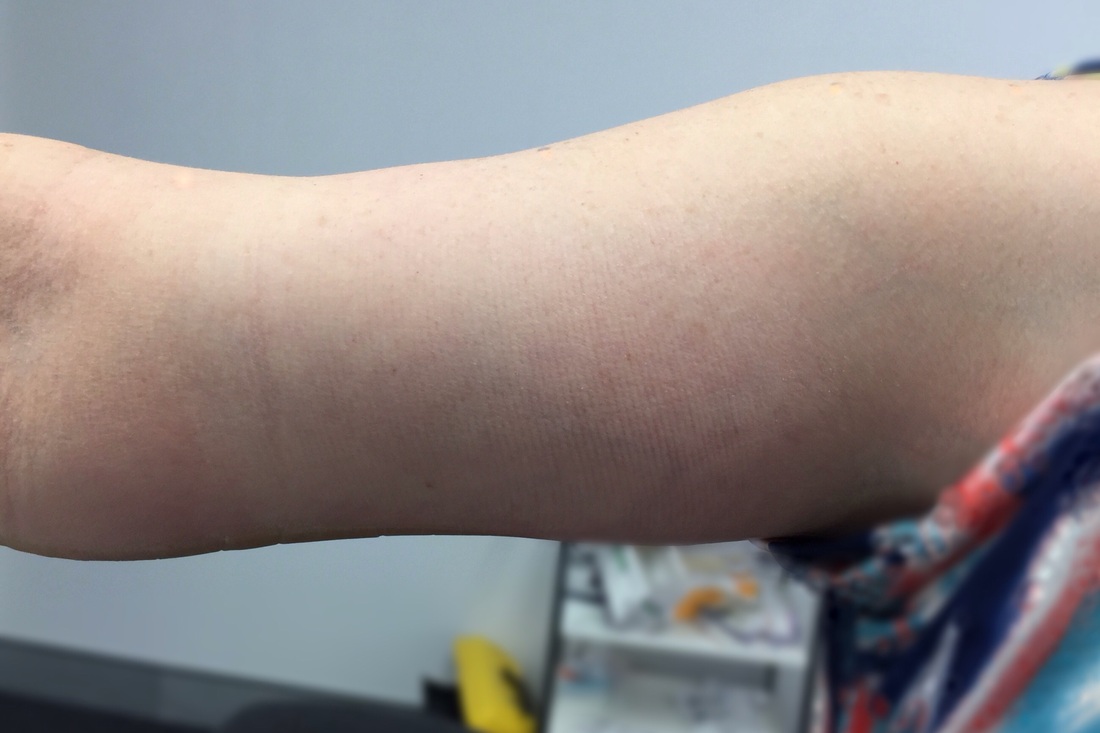 arm4.jpg