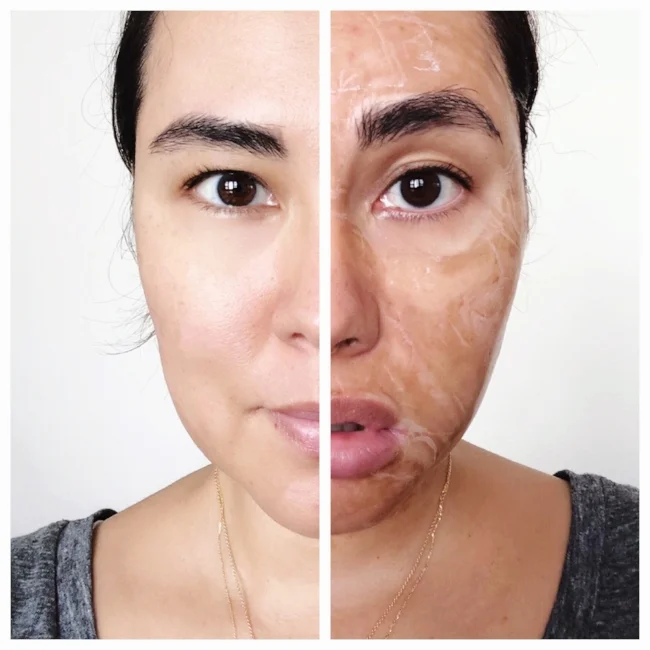 Oops I Did It Again (Round 2 of Hanacure)