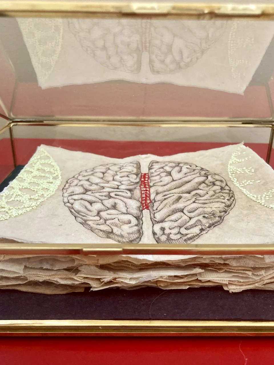 Lees-Maiberg-Brain.jpg