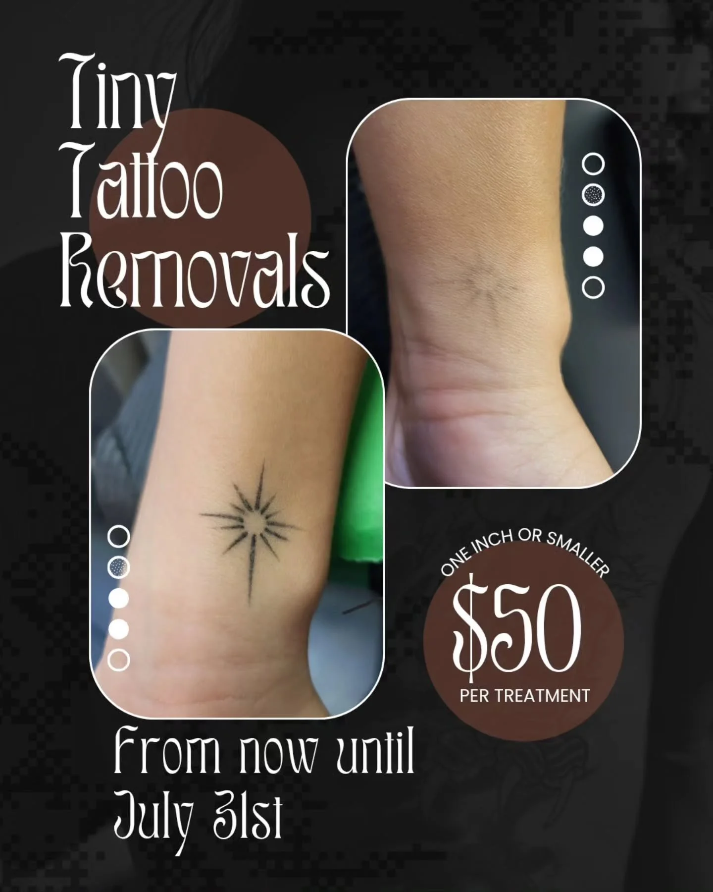 ✨️ Tiny Tattoo Removals ✨️

Do you have a lil guy? Just a pesky lil guy you want to work on removing? I got you! 
 I am offering laser sessions on tattoos that are one inch or smaller for $50 per treatment from now until July 31st.

DM or email  me a