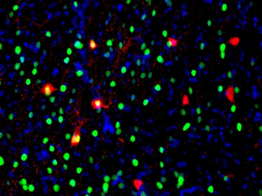  tdTom in putative crh neurons (red), cFos-ir (green) 