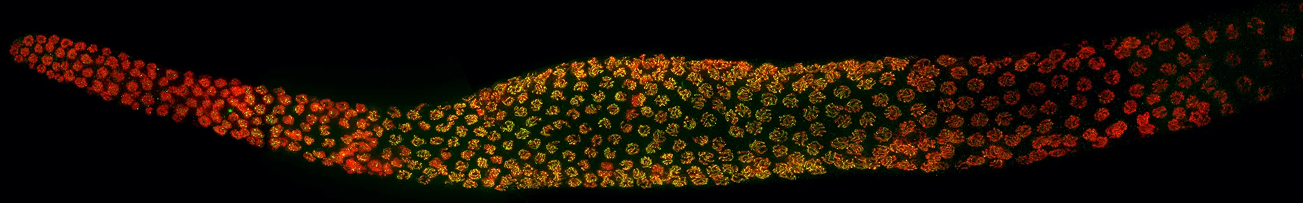C. elegans germline undergoing meiosis stained to visualize DNA (red) and the protein PCH-2 (green)
