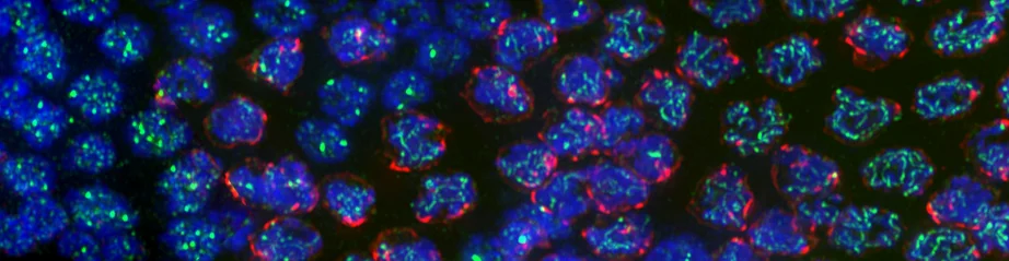 C. elegans meiotic nuclei stained to visualize DNA (blue), PCH-2 (green) and a marker for meiotic entry, phosphorylated SUN-1 (red)