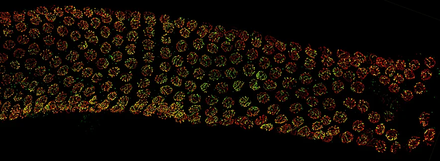 C. elegans meiotic nuclei stained to visualize DNA (red) and the recombination protein ZHP-3 (green)
