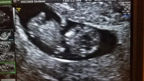 Baby.jpg