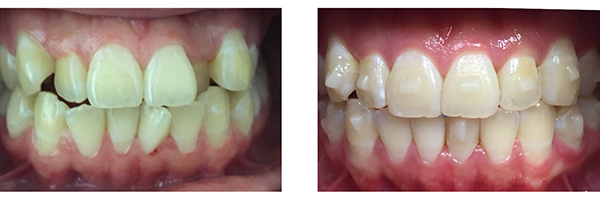 7 month treatment