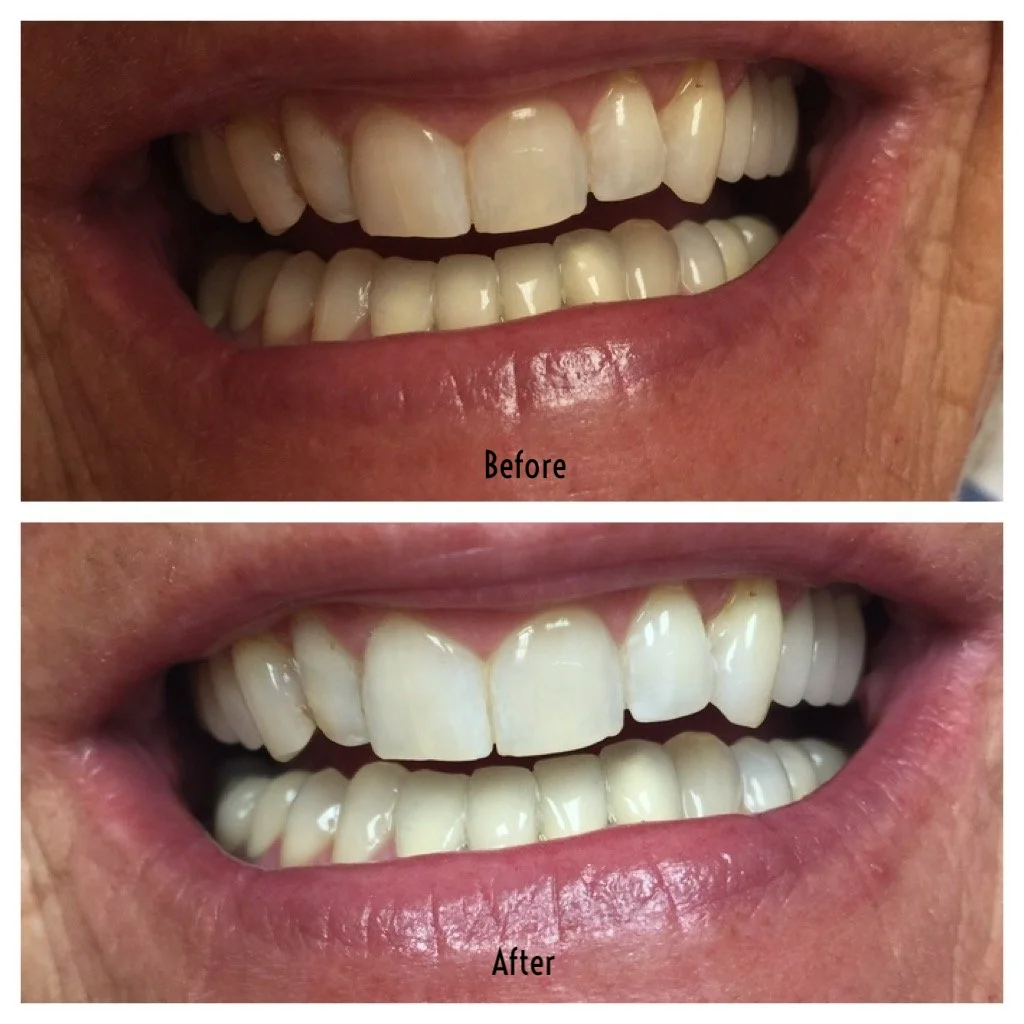 before&after.jpg