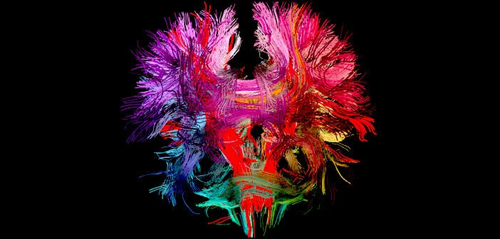 Neural-Connections-In-the-Human-Brain-Radu-Jianu-Brown-University.jpg