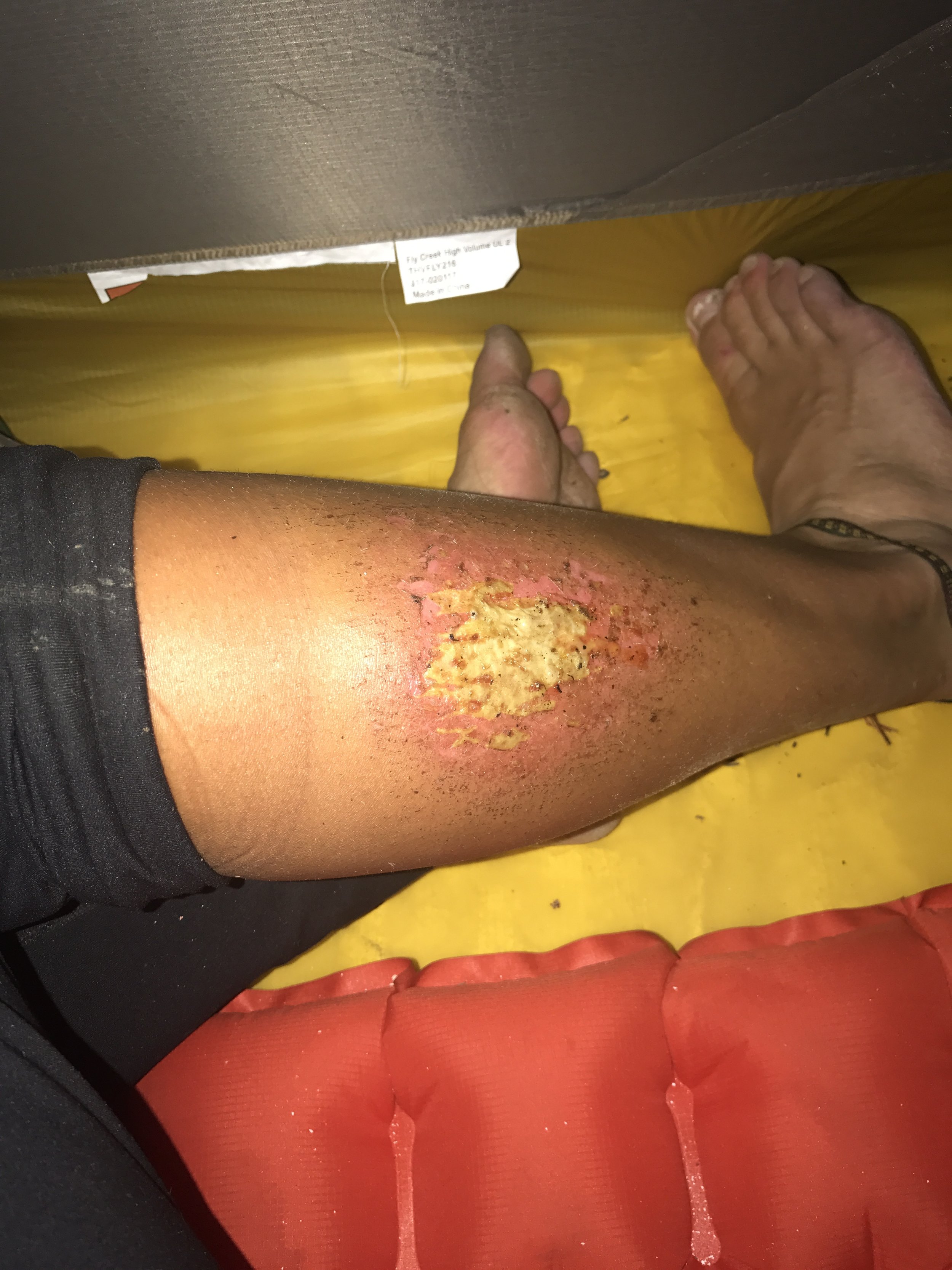 Just kidding...fuckn yikes
