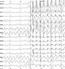EEG.jpeg