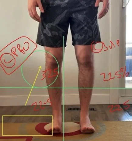 When The Knee Speaks For The Whole Body