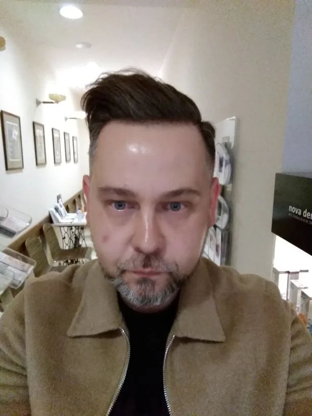 Tuż po zabiegu…