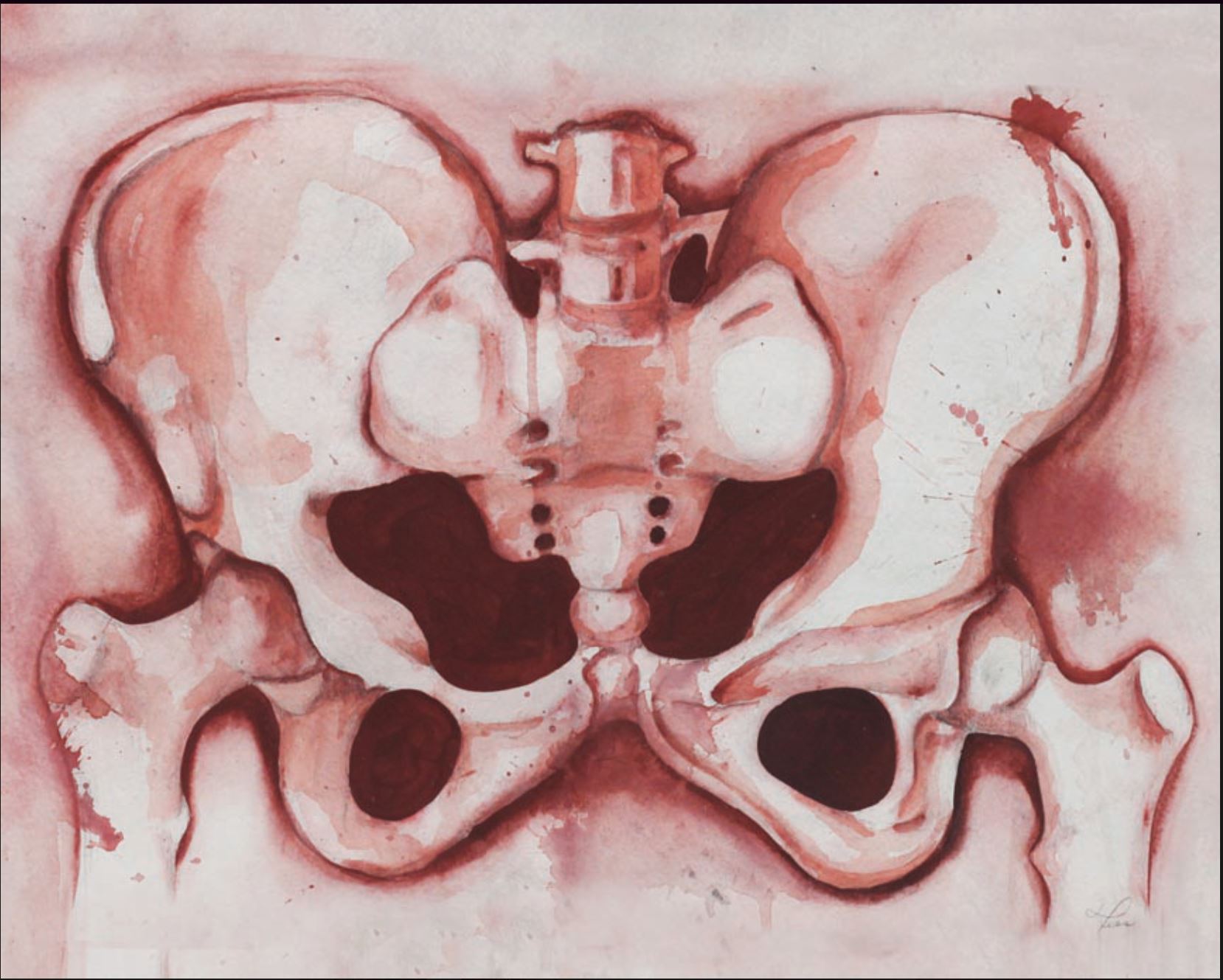 Pelvis