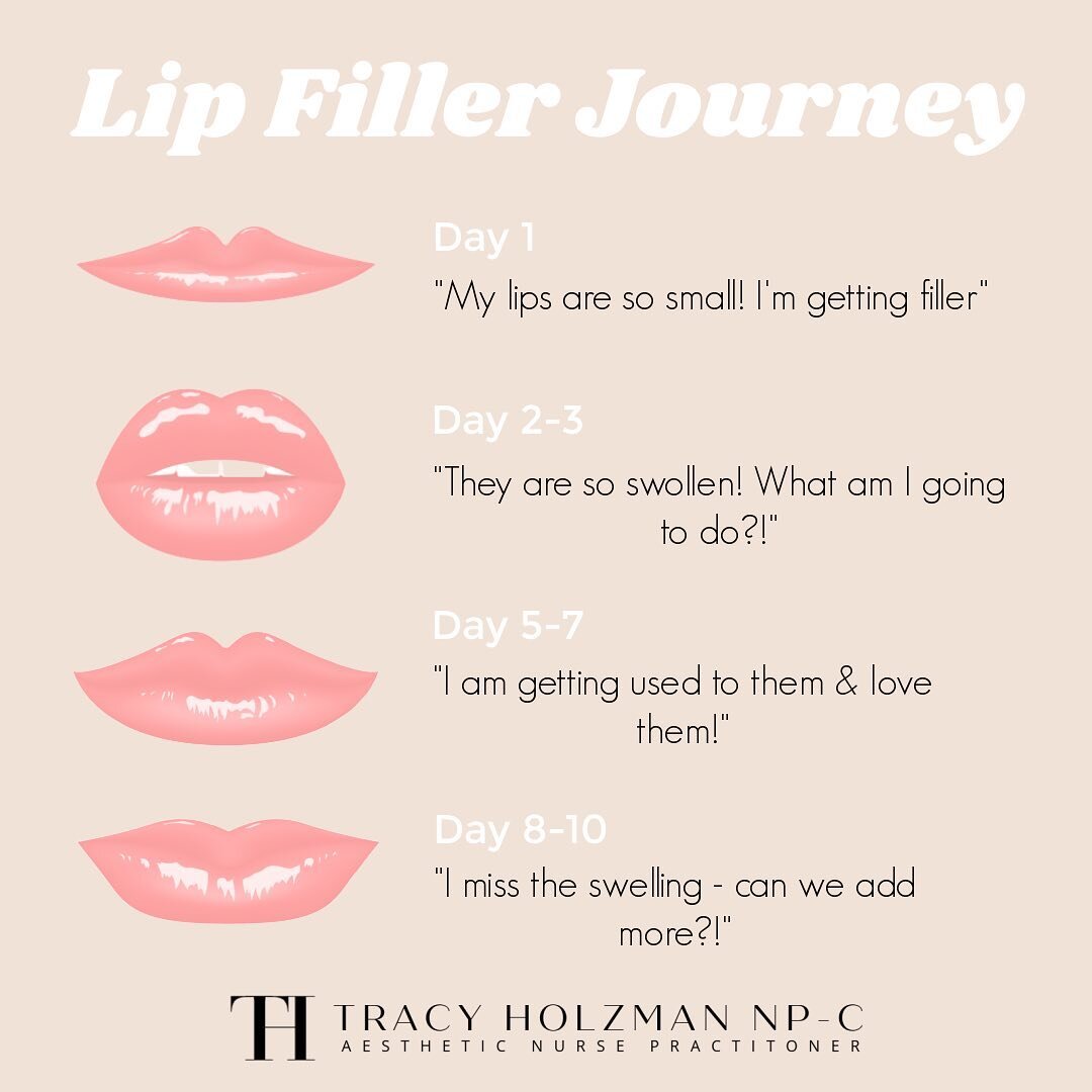 The lip filler journey ✨

First time getting lip filler? Here is what the healing process will look like!

Tracy Holzman NP-C
(@tracyholzmannp)

Amanda Muiter RN
(@amandaraenp)

Victoria Kartseva Master Aesthetician
(@v_medesthetics)

Book with us!
+