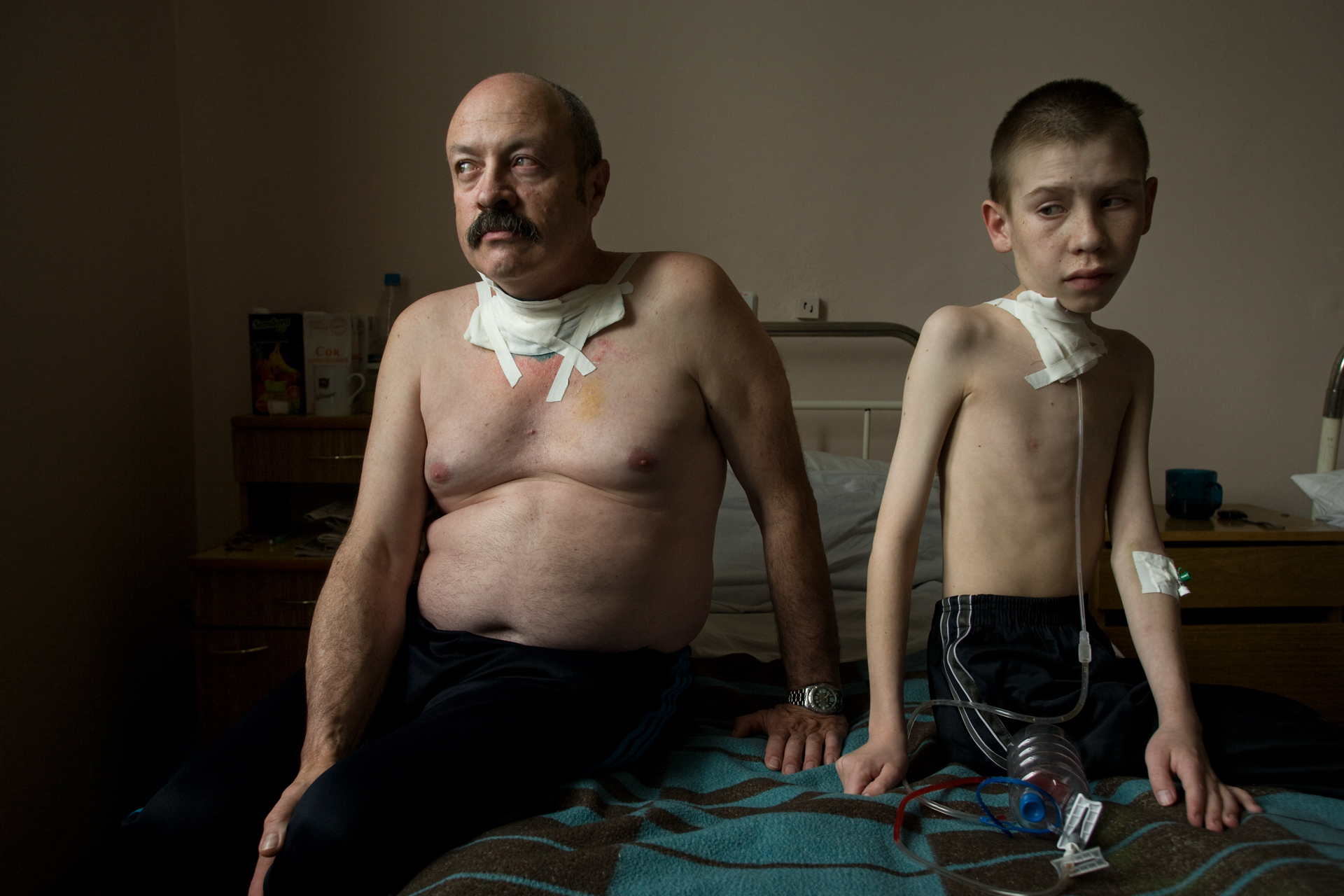  Suffering from thyroid cancer, which has been linked to the Cesium fallout from the Chernobyl accident, Oleg Shapiro, 54, and Dima Bogdanovich, 13, receive care at a thyroid hospital in Belarus.  Minsk, Belarus  