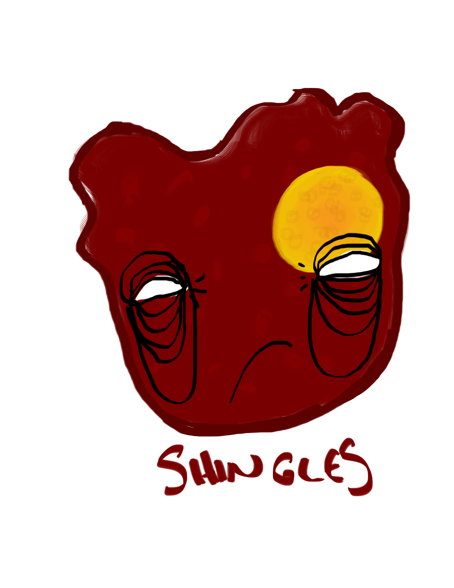 shingles.png