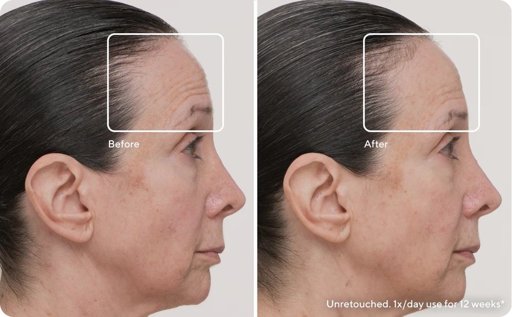 TheraFace-LED-Mask-Wrinkle-Benefit-1-Desk_1000x1000.jpeg