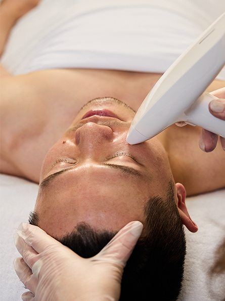 Client in North Melbourne skin clinic receiving advanced skin treatment, Universal IPL.
