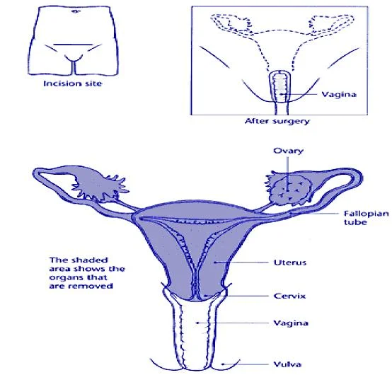 The uterus, tubes and ovaries