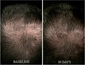 beforeafter.jpg