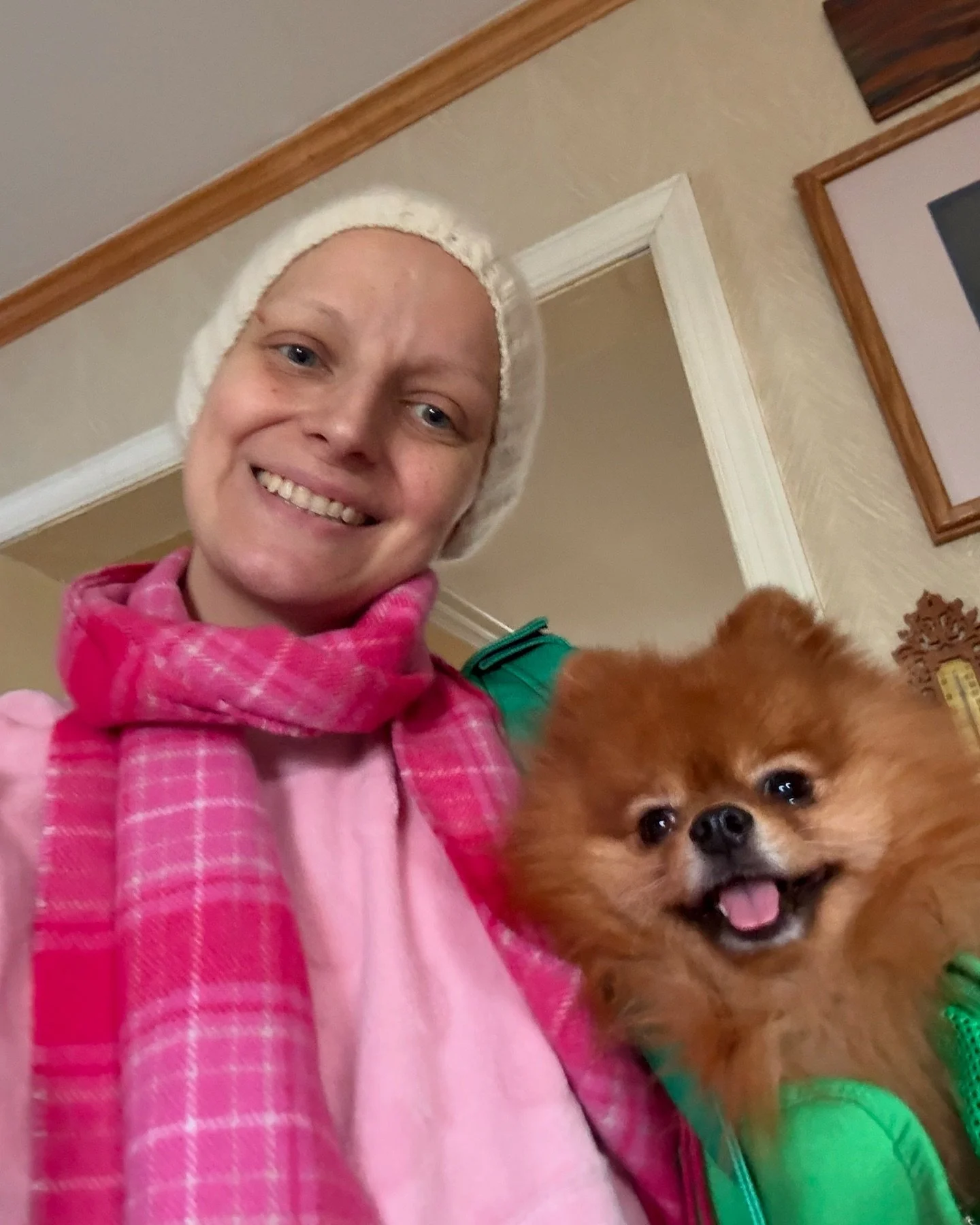 Slept most of the day yesterday and still not feeling 100% but I&rsquo;m 75% better #metastaticbreastcancer #breastcancer #baldballerina