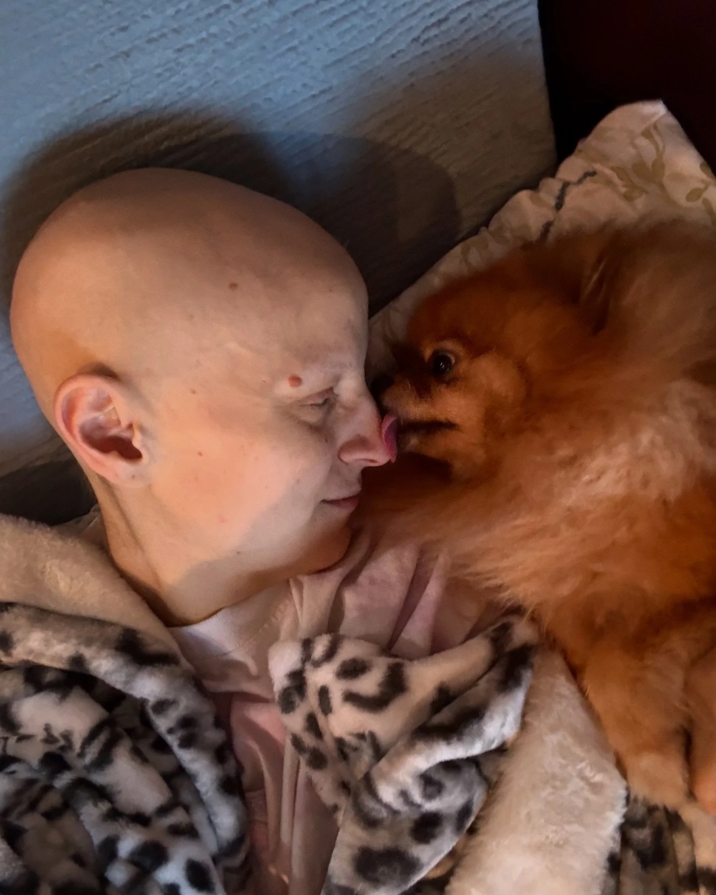 I have a bad update. Last night around 11pm I had a seizure. We arrive at the ER around 12am. I was admitted to the hospital since that and will be observed and treated. About to meet with my oncologist and neurologist for treatment updates. I will t