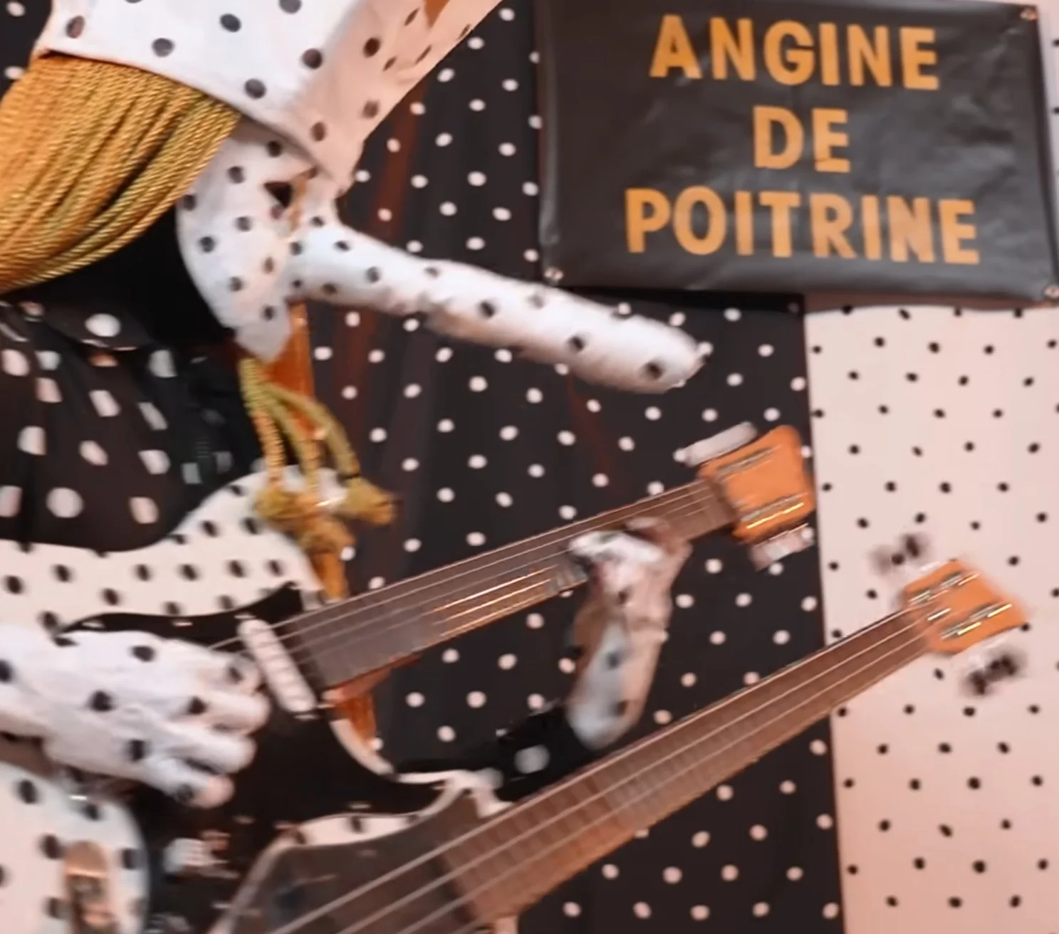 Angine de Poitrine